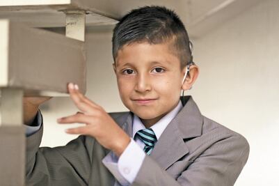 DIF: 36 niños con sordera reciben implantes