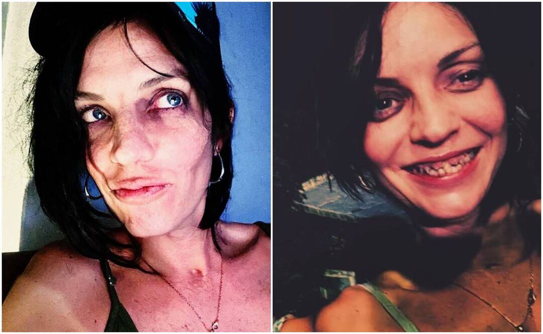 Camilo Blanes, el único hijo del cantante Camilo Sesto preocupa a sus fans por seguir inmerso en las adicciones y presumirlo en redes.