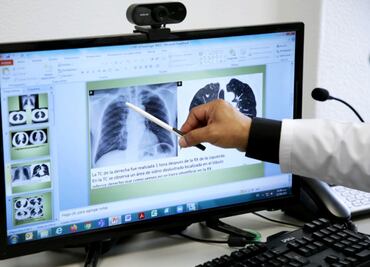 Atiende IMSS a más de 177 mil pacientes con secuelas de Covid-19