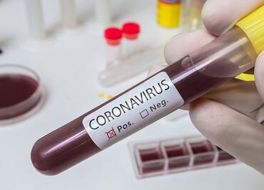 Covid-19 genera ‘pandemia de desinformación’