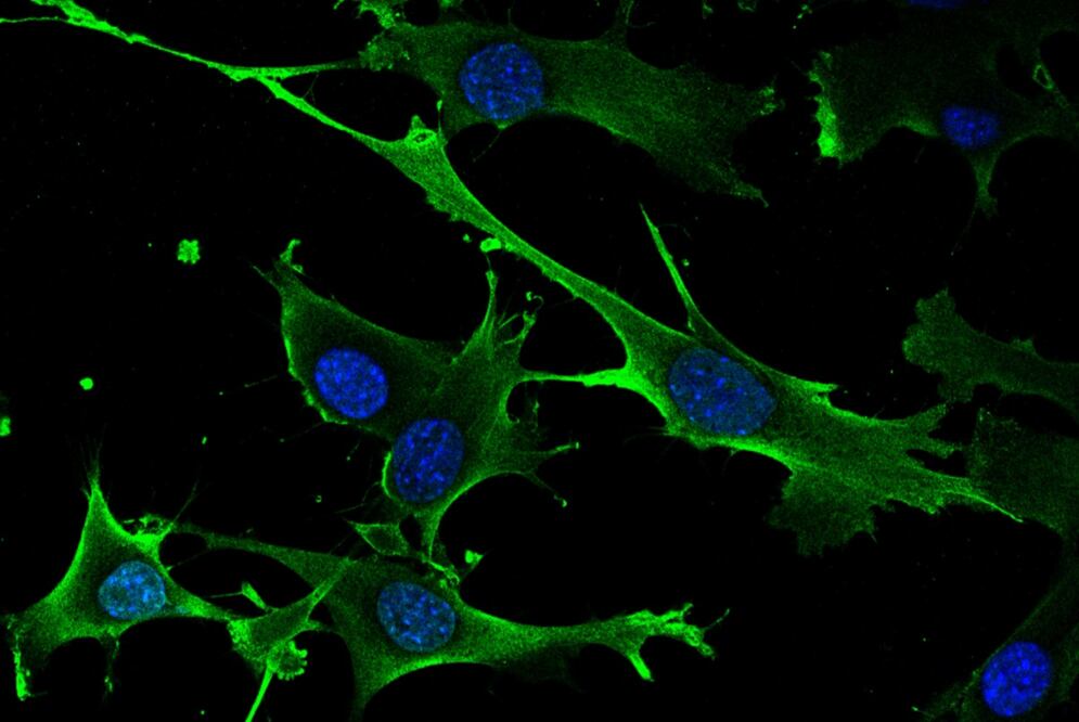 Imagen: Consejo Superior de Investigaciones Científicas