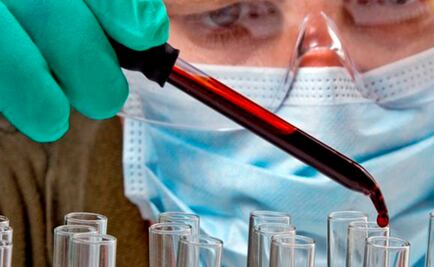 VIH: 60 millones de infectados; las lecciones de otra pandemia