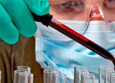 VIH: 60 millones de infectados; las lecciones de otra pandemia