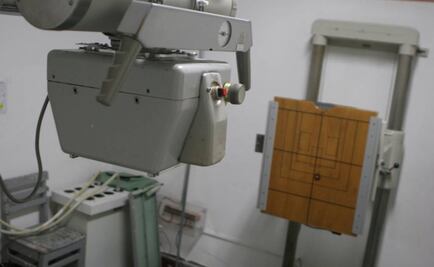 Personal médico expuesto a rayos X tiene más riesgo de cáncer