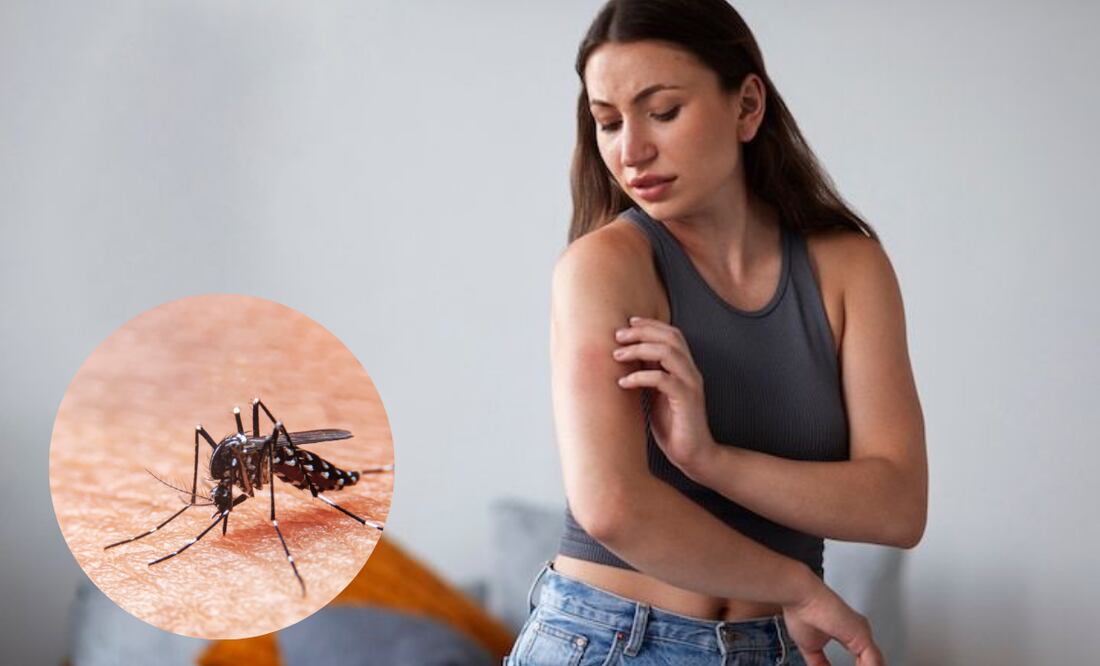 ¿Por qué un mosquito pica más a una persona que a otra?
Foto: El Universal