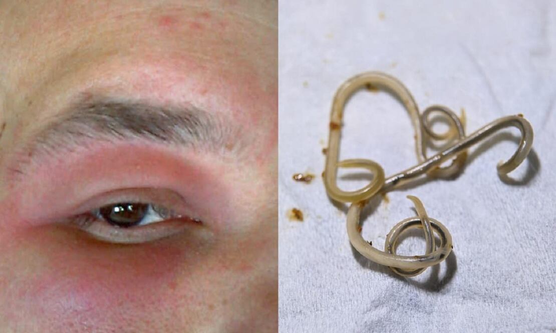 Un hombre acudió al médico por sufrir una migraña insoportable. FOTO: ESPECIAL