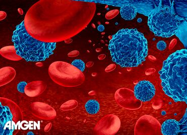 Tratamientos contra mieloma múltiple dan más esperanza