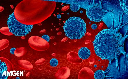 Tratamientos contra mieloma múltiple dan más esperanza 