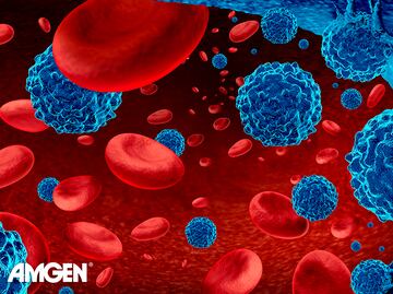 Tratamientos contra mieloma múltiple dan más esperanza