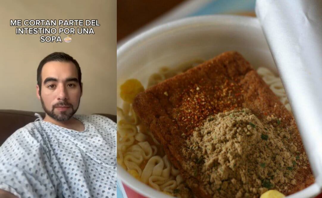 Joven termina en el hospital por problemas intestinales provocados por sopa instantánea. Foto: Especial y TikTok @ricardo.cerda
