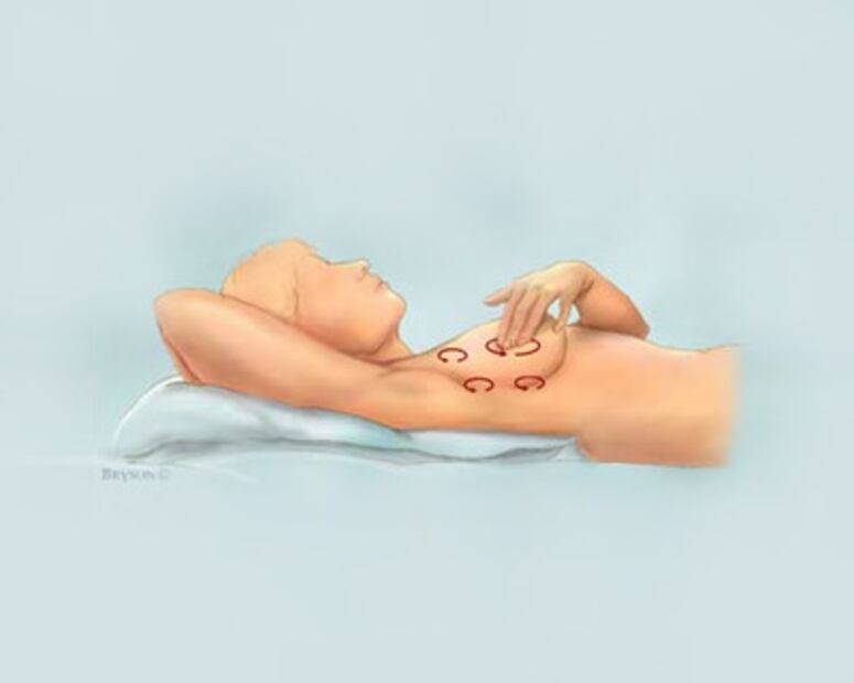 Cáncer de mama, cómo detectarlo y factores de riesgo