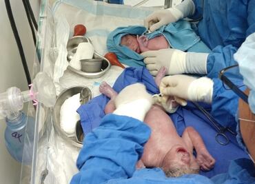 Nacen gemelos en hospital reconstruido tras sismos en Oaxaca