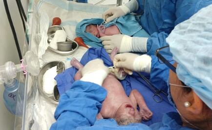 Nacen gemelos en hospital reconstruido tras sismos en Oaxaca