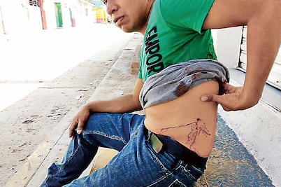 “Había heridos de bala en piernas y rodillas”