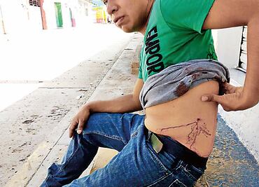 “Había heridos de bala en piernas y rodillas”