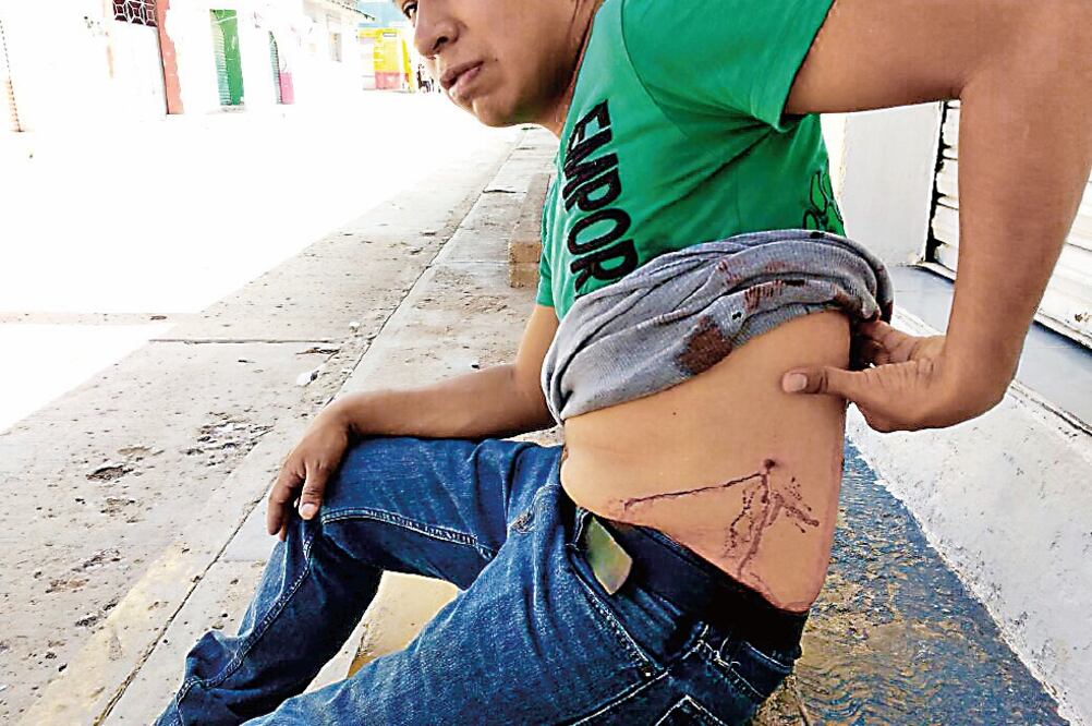 El joven llevó una caja de refrescos a las personas que estaban en el enfrentamiento, al levantarse, sintió el impacto del proyectil (JUAN CARLOS ZAVALA. EL UNIVERSAL)