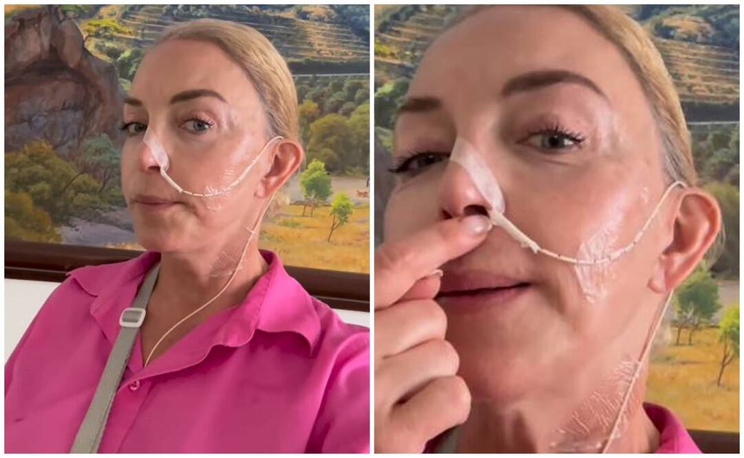 Laura Flores comparte problema de salud