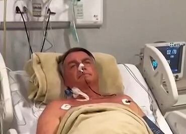 Concluye con éxito cirugía de Jair Bolsonaro; intervención duró 12 horas