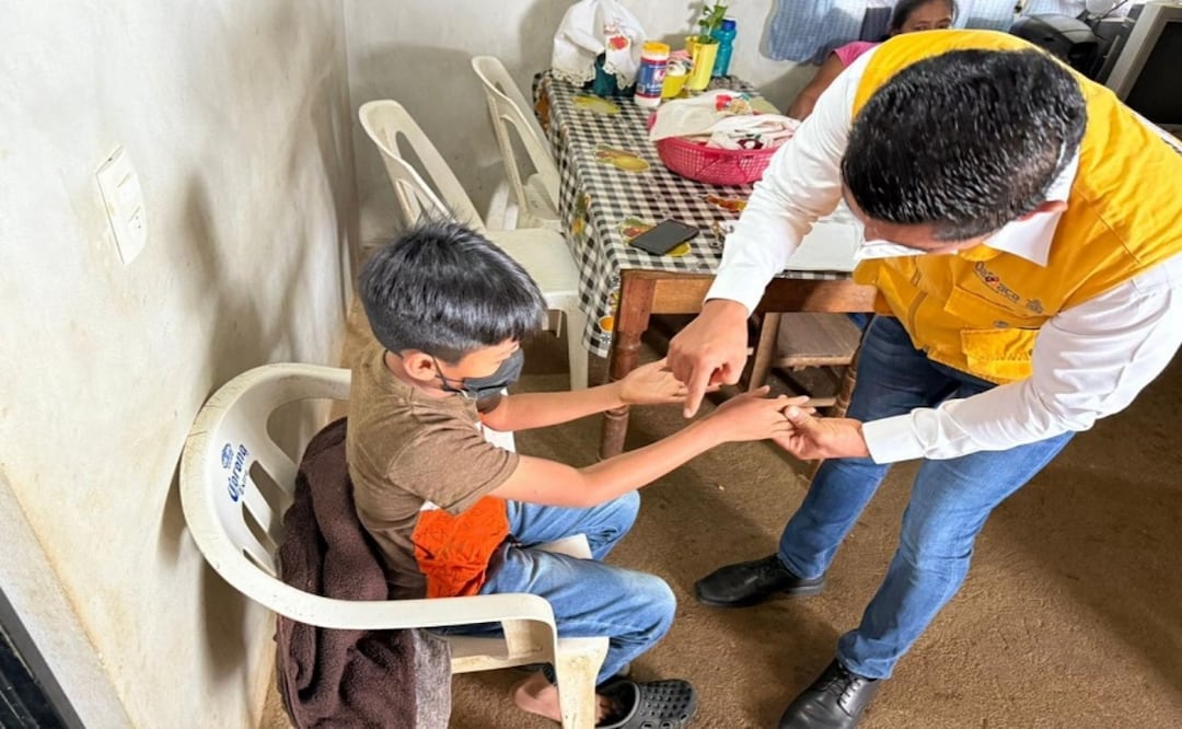 Oaxaca reporta 753 casos de virus Coxsackie; menores de 5 años, los más afectados. Foto: Especial