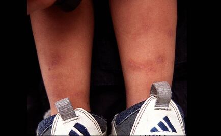 Crece número de menores torturados, alerta ONU