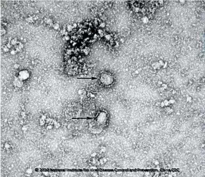 Así se ve el coronavirus de Wuhan desde el microscopio, autoridades difunden micrografía