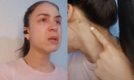 “Me secuestraron y me dispararon en la cara”: joven venezolana relata cómo sobrevivió
