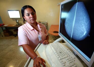Una proteína podría ser la responsable de favorecer a la metástasis