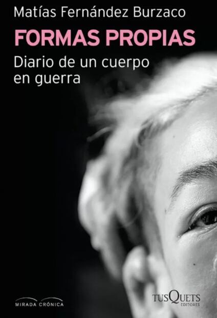 "Soy raro, soy deforme, lo voy a contar todo": escritor argentino cuenta su experiencia con fibromatosis 