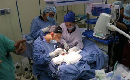 Médicos extraen protuberancia en el cerebro de una bebé en Tabasco