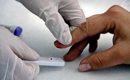 VIH y sida, ¿son lo mismo?