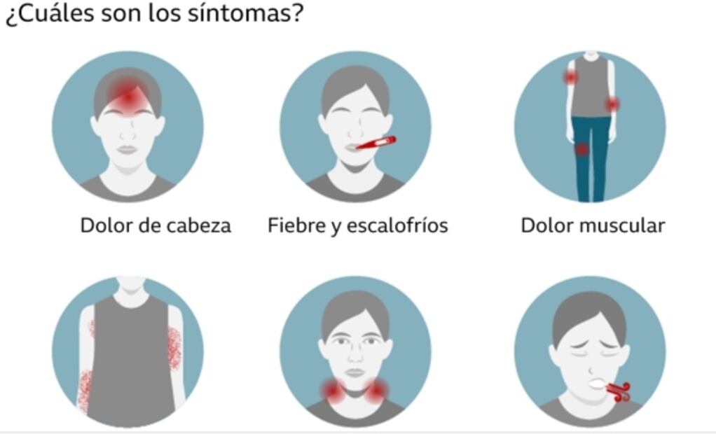 Edomex registra dos casos de viruela del mono