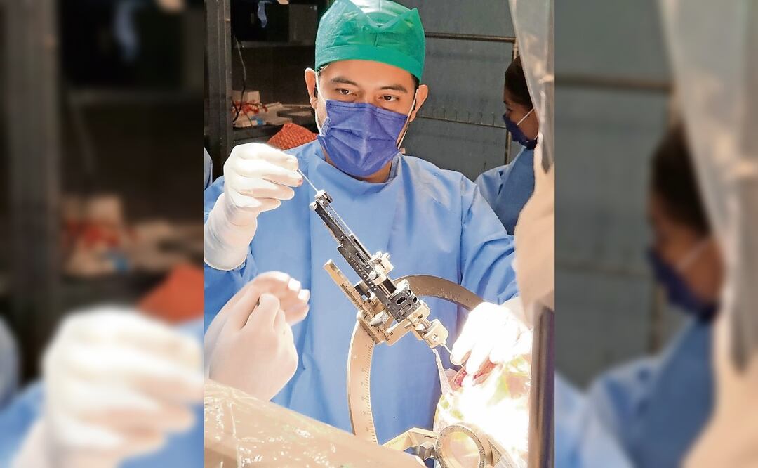 En Coahuila realizan la primera estimulación cerebral profunda del país. Foto: Especial