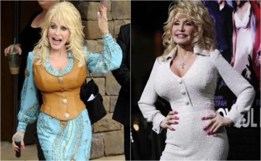 Personalidades de la moda que se pasaron de cirugías