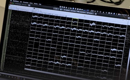 Pacientes con parálisis total podrán comunicarse con ayuda de inteligencia artificial