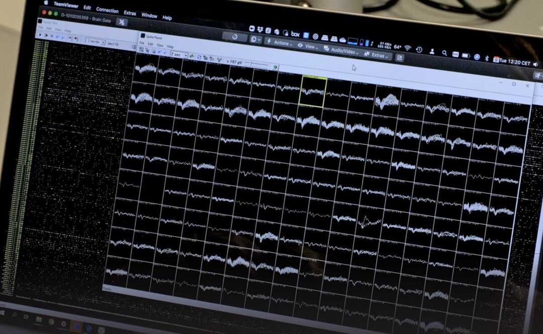 Foto: Centro Wyss Center de Neuroingeniería