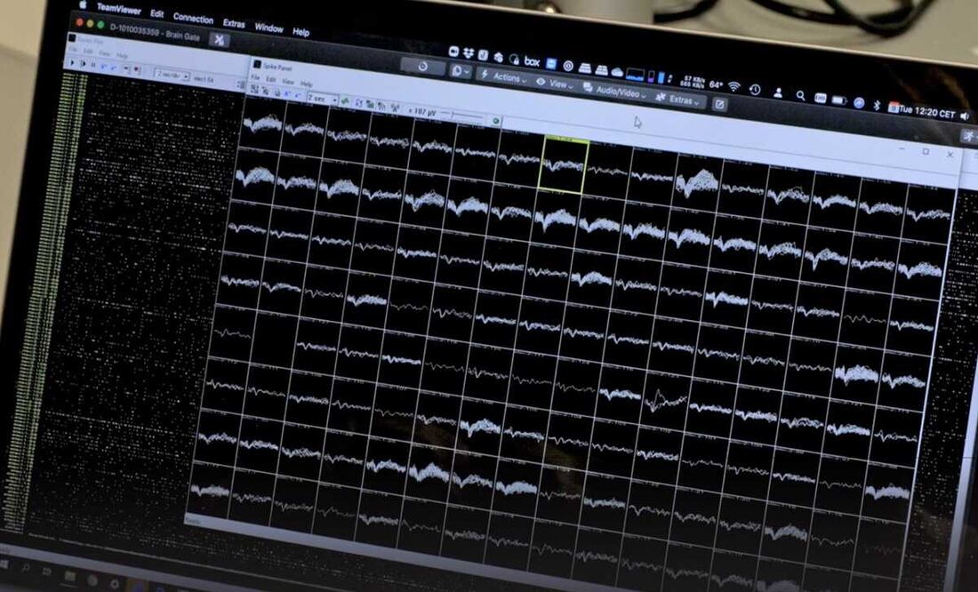 Foto: Centro Wyss Center de Neuroingeniería