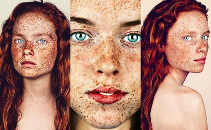  Este fotógrafo retrata a personas con pecas y se viraliza