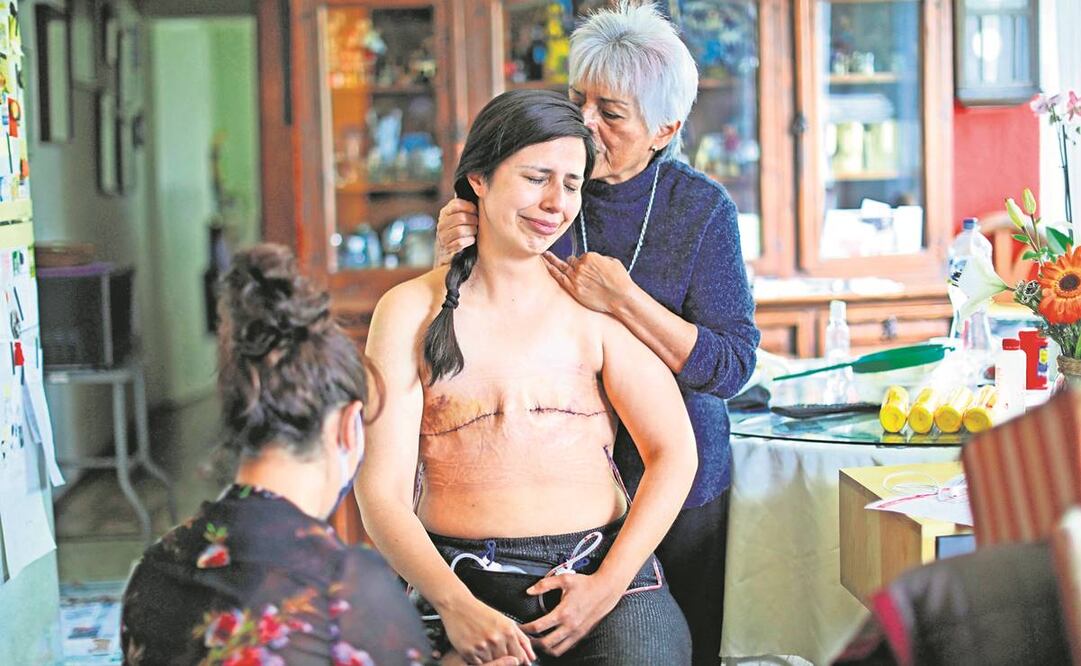 Jódete cáncer es el nombre de la imagen que retrata el momento en que la joven Sandra Monroy vuelve a casa tras una mastectomía. Foto: Sashenka Gutiérrez/ EFE.