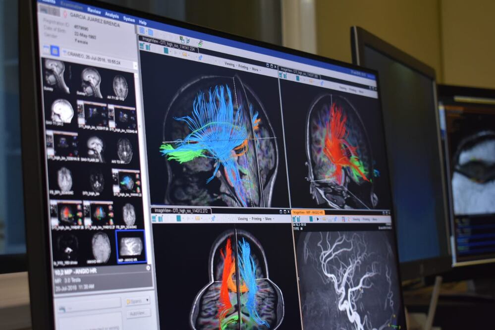 Fotografías Especiales