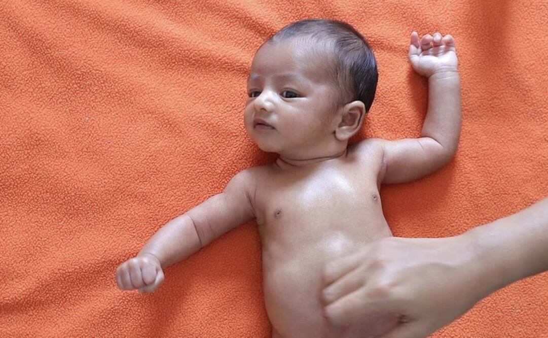 El simple masaje que puede salvar vidas de bebés prematuros