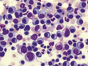 Director del INCan pide a AMLO revisar el Seguro Popular antes de desaparecerlo