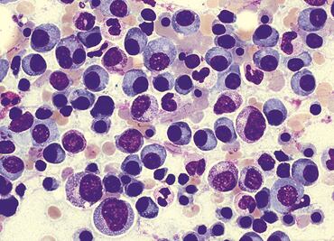 Director del INCan pide a AMLO revisar el Seguro Popular antes de desaparecerlo