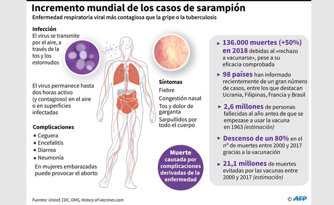 Unicef advierte aumento "alarmante" de sarampión a nivel mundial