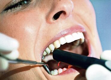 Mitos y realidades sobre las caries, ¿Cómo mantener una buena higiene bucal?