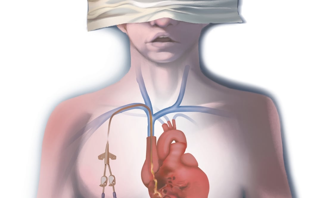 Aumenta el riesgo de muerte por contagios hospitalarios. Ilustración de Liliana Pedraza