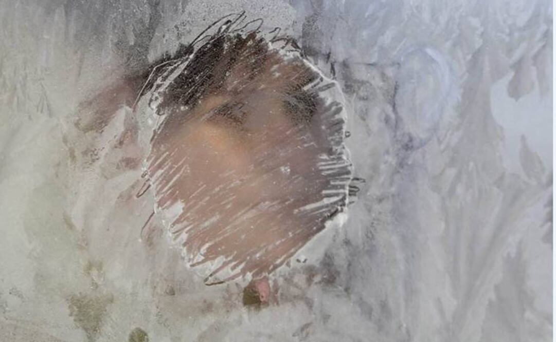 Actualmente buscan voluntarios para el proyecto y aún no se conoce el costo. Foto: Archivo EFE