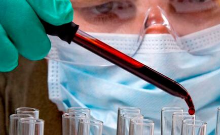 Secretaría de Salud alerta por VIH y sarampión en Rusia