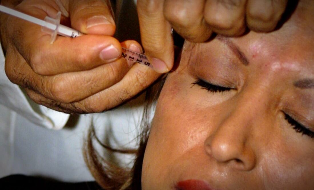 Senadores, diputados, médicos y especialistas destacaron que se avanza en un marco legal en México para separar la cirugía plástica reconstructiva de la cirugía estética. Foto: archivo/EL UNIVERSAL