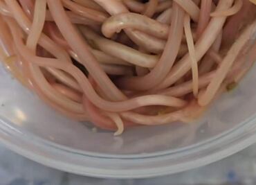 Extirpan 142 lombrices a niño en Chiapas; llegó a clínica con vómitos y dolor abdominal