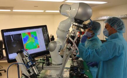 El robot cirujano que opera con más precisión que médicos